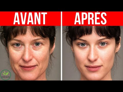 Vidéo: Que manger pour avoir une peau plus rebondie ?