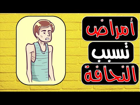 احذر من تلك الأمراض إذا كنت نحيف أمراض تسبب النحافة علاج النحافة