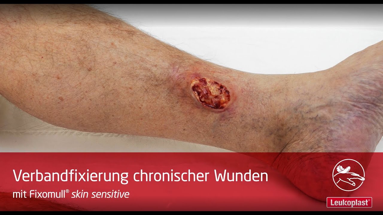 video-thumbnail