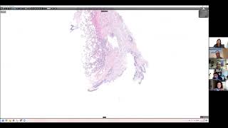 Fresh Air, Season 2, Episode 5: Interesting Cryobiopsy Cases (Interstitial lymphocytes, UIP, PAP)