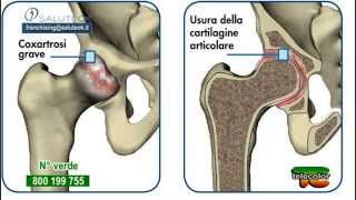 Salute ok - puntata 8 - 3°stagione