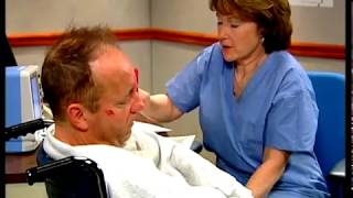 Emergency Severity Index Pt.2: Practice Cases - 13 Alcoholic With Head Injury