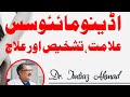 Dr imtiaz ahmadbest adenomyosis doctor in pakistan