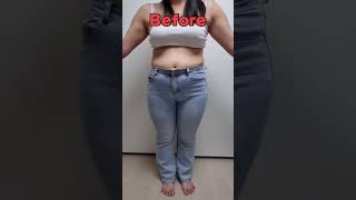 지방흡입 수술 후 달라진 몸매와 출근룩👩🏻‍💻🫢❤️ #허파고리 #골반이식 #복부지흡 #룩북 #shorts