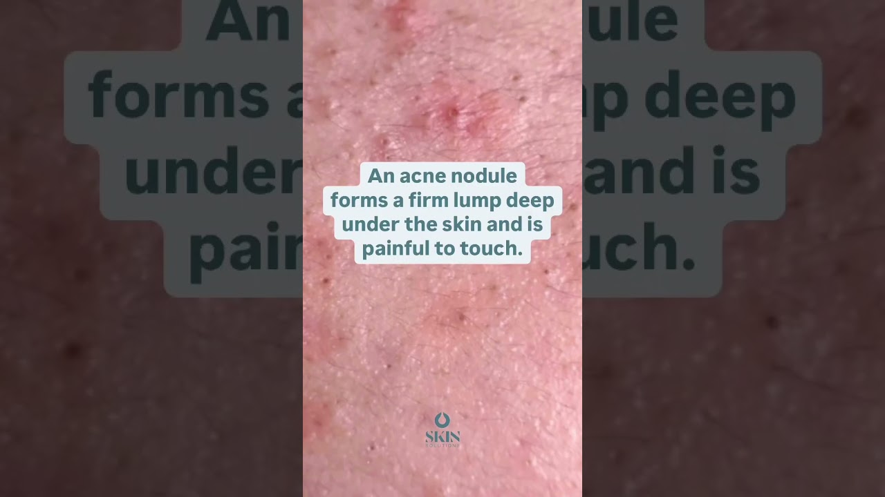 Seriskin The French Plump Peptide That Fights Wrinkles & Fine Lines! the link to is in the comments!