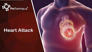 Download Lagu Heart Attack MP3 Download Lagu Heart Attack MP3