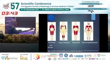 Muscle MRI in Musclular Dystrophy
