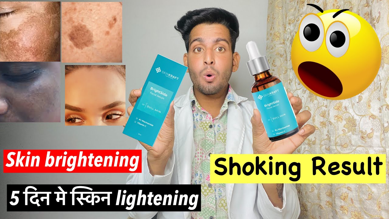 Skinkraft brightside serum hindi review Skinkraft brightside facial serum skinkraft reviews