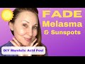 Fade melasma  sunspots on a budget