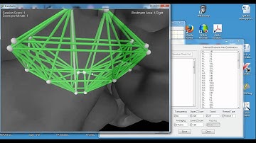 Pain Network Video Thatcher