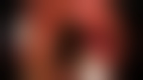 ascending colon ulcerated lipoma and let go with endoloop