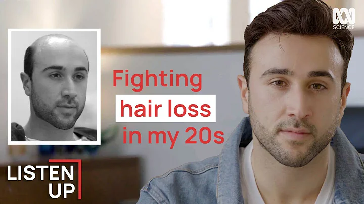 “I Started Losing My Hair At 20” | Listen Up | ABC Science - DayDayNews