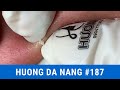 #187 | Huong Da Nang
