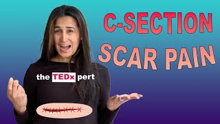 Dealing with C-Section Scar Pain During Your Second Pregnancy: Tips and Advice