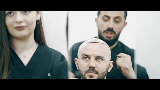 Turkish Hair Center Çağlar Korkmaz Saç Ekimi Tanıtım Videosu Hair Transplantation Turkey