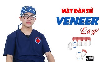 Mặt dán sứ veneer | dán sứ veneer là gì?