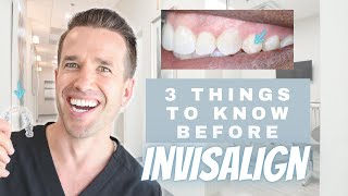 What You Need to Know Before Starting Invisalign | Dr. Nate