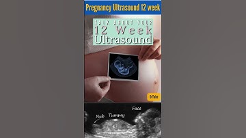 pregnancy week by week development | pregnancy week by week 12 #pregnancy #ultrasound #shorts