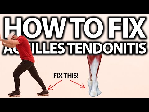 How To Fix Achilles Tendonitis FAST!