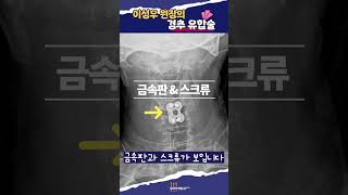 목 뒤, 등 뒤, 팔에 저린 증상이 있다?