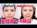 【検証】美顔器って効果あるの？1か月使い続けてみた