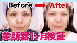 【検証】美顔器って効果あるの？1か月使い続けてみた