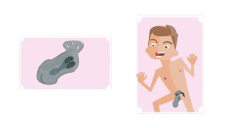 Аксессуар для электростимуляции - пояс верности Mystim Pubic Enemy No.1 Аксессуар для электростимуляции - пояс верности Mystim Pubic Enemy No.1