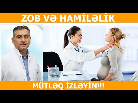 DİQQƏT!!! Zobu olan qadınlar hamilə qala bilmərmi?  Dr.Sadiq Bəbirov