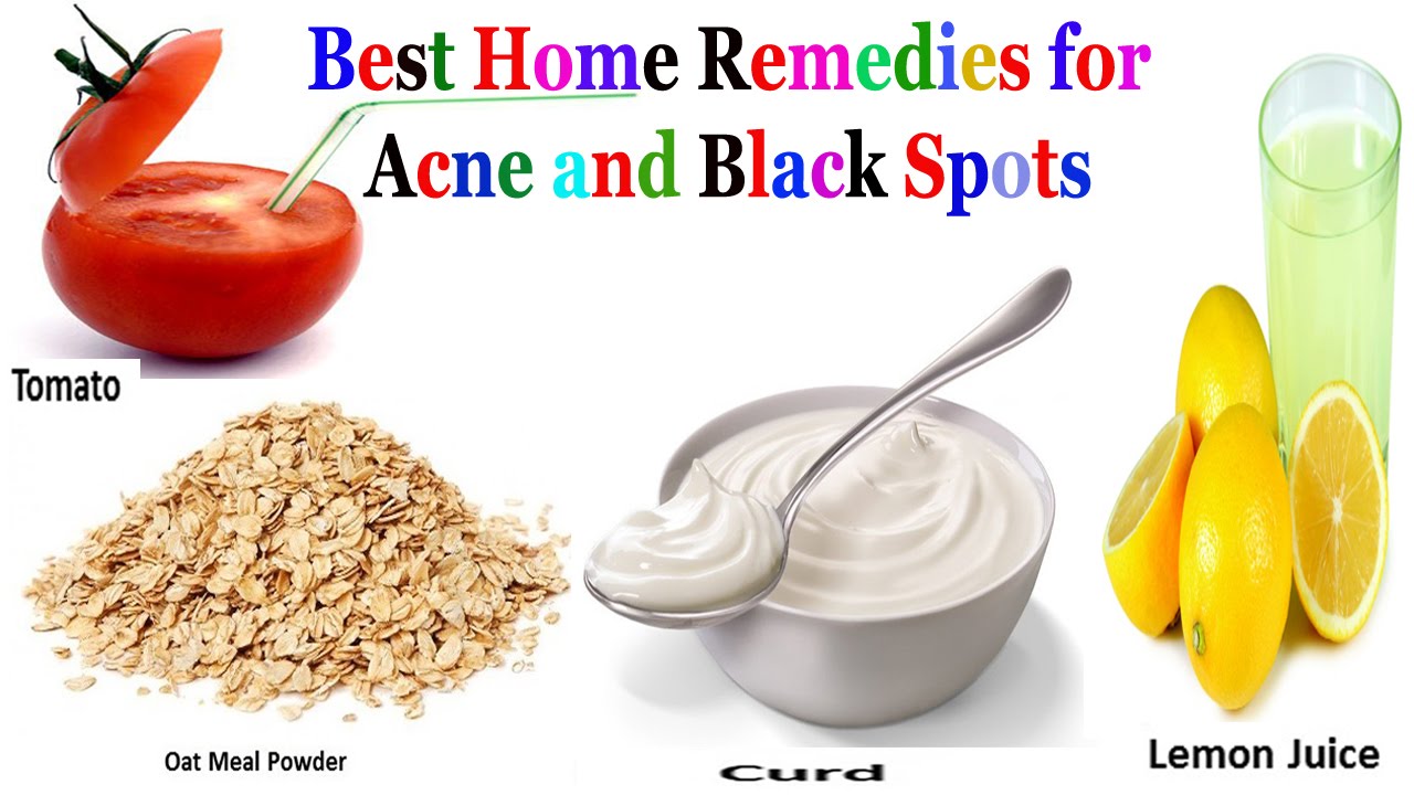 best-home-remedies-for-acne-and-black-spots-how-to-get-flawless-skin