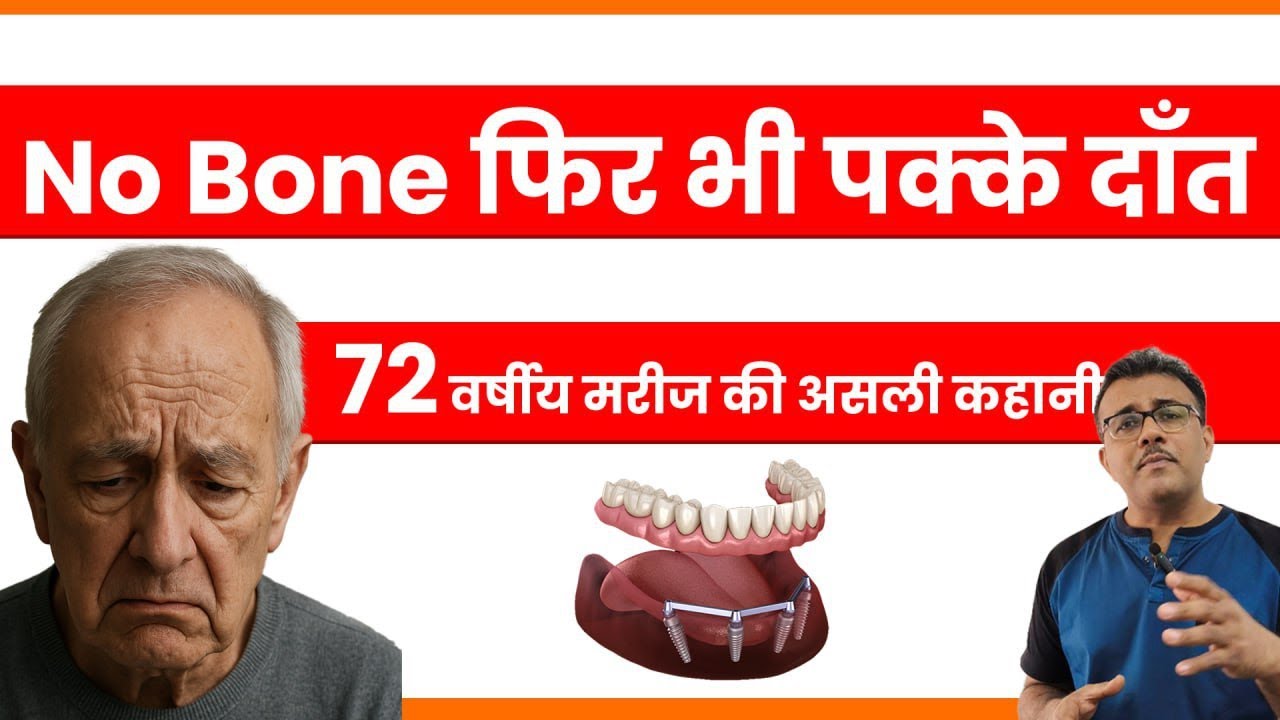 No Bone? No Problem!  72-Year-Old Gets Permanent Teeth | Real Patient Story!