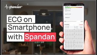 How to take an ECG with Spandan | ECG on Smartphone | In 4 Simple Steps | Step-by-Step Guide screenshot 3