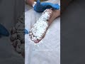 Проба Минора