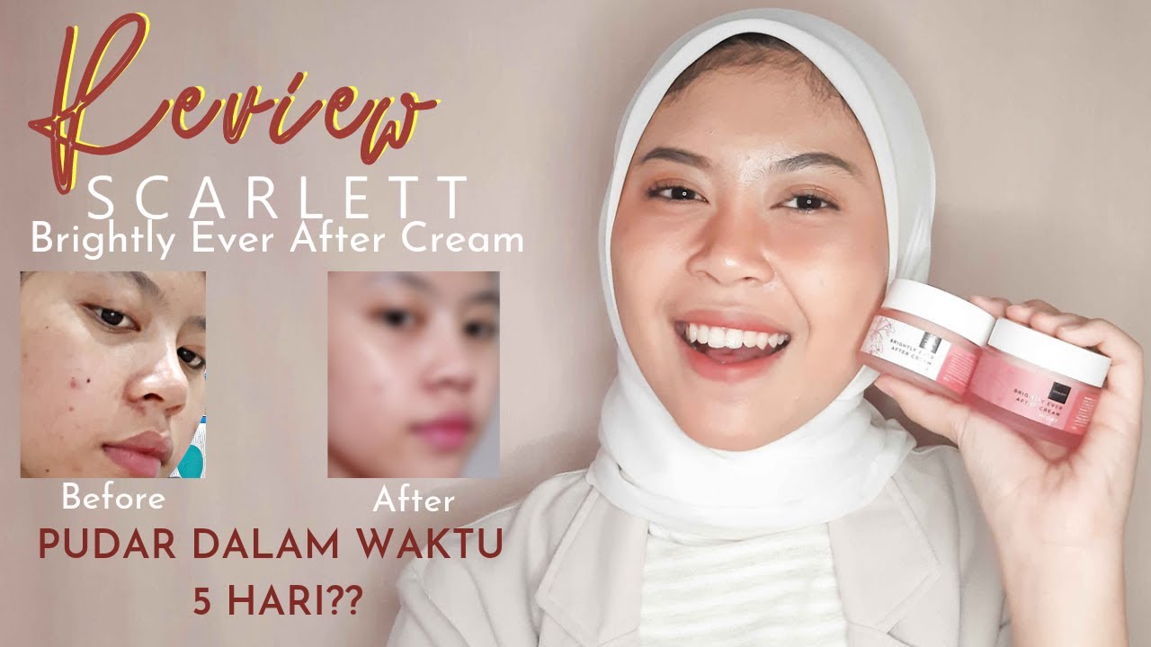 REVIEW SCARLETT BRIGHTLY EVER AFTER CREAM! PEMAKAIAN 5 HARI | SHELAADAWIYAH