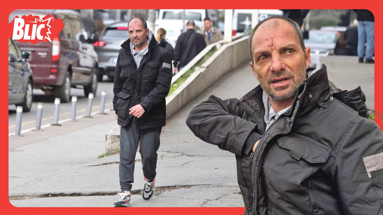 SIN SNEŽANE ĐURIŠIĆ IZAŠAO IZ BOLNICE Posekotine i ožiljci na licu nakon stravičnog mučenja