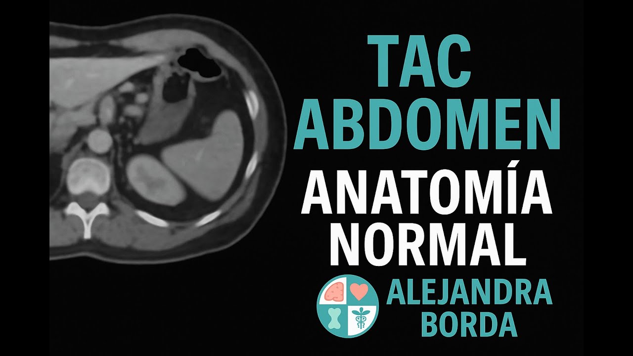 TAC de Abdomen | Anatomía Normal Explicada para Estudiantes de Medicina