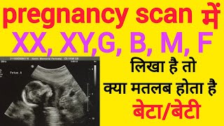 If XX, XY, M, F, G, B is written in the pregnancy ultrasound, then it means son or daughter.