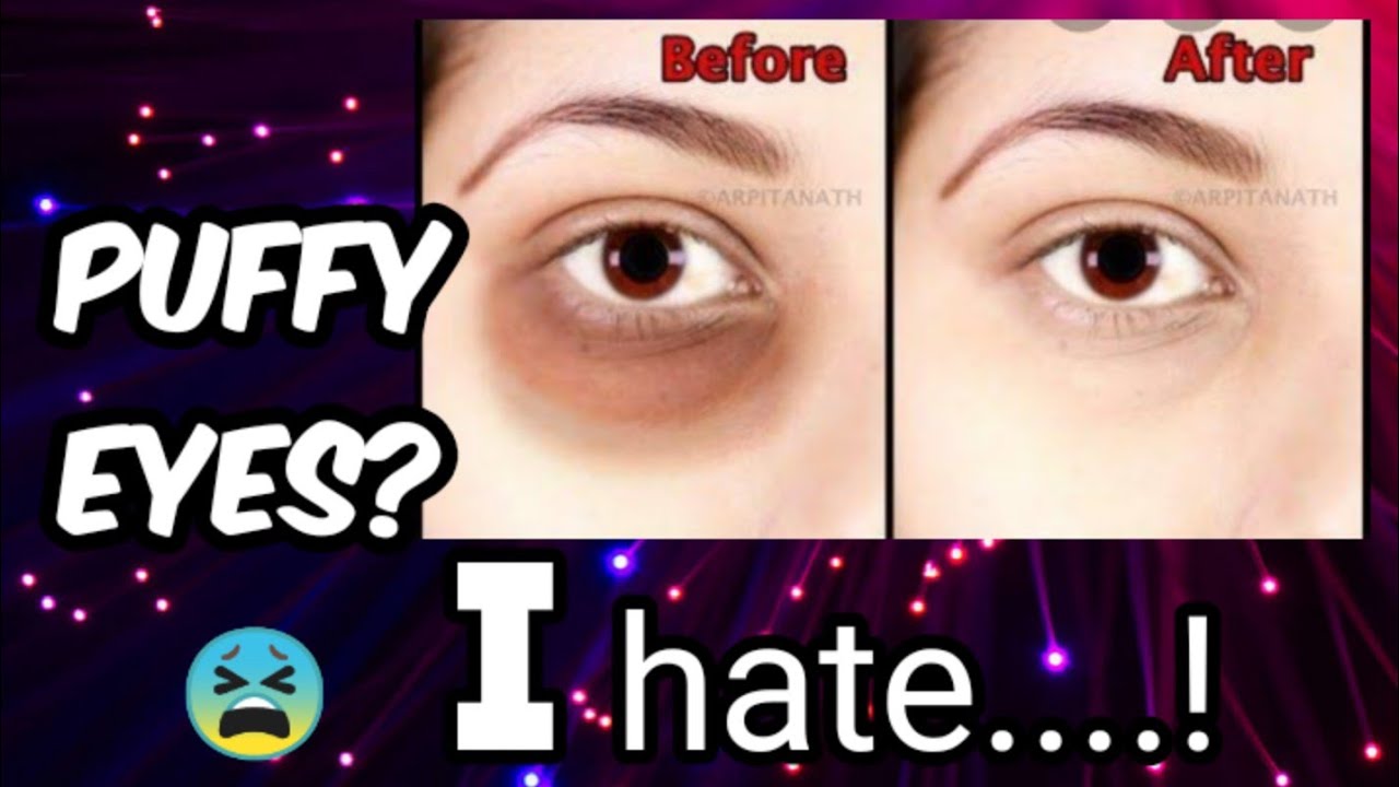 PUFFY EYES Solution of PUFFY eyes and DARK CIRCLES Hoor Saloon by