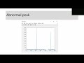 การทำ Preprocessing Data ด้วย MATLAB (ตอนที่ 1 : Abnormal Peak)