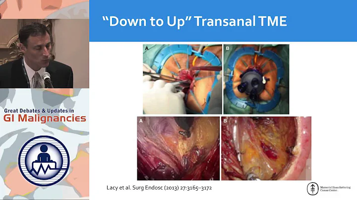 Update 4: New Minimally-invasive Surgical Approaches for Rectal Cancer