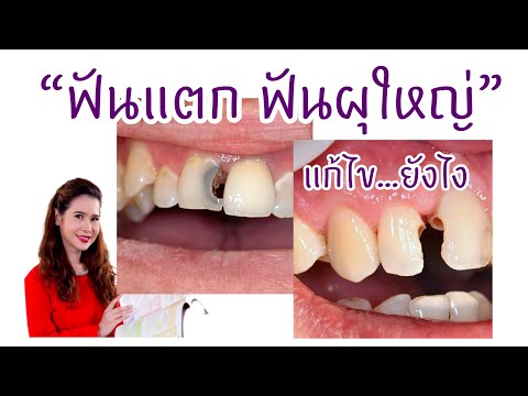 ฟันแตก ฟันผุใหญ่ ฟันราว ฟันหัก แก้ไข ได้ ยังไง / รักฟันวันละ 1 นาที by หมอโอ๋