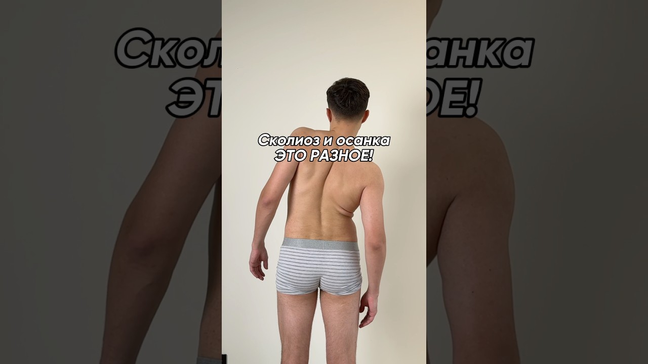 Чем отличается сколиоз от осанки?