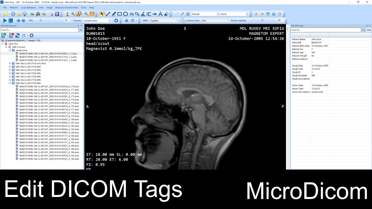 How to Edit DICOM Tags in MicroDicom | DICOM Viewer Tutorial