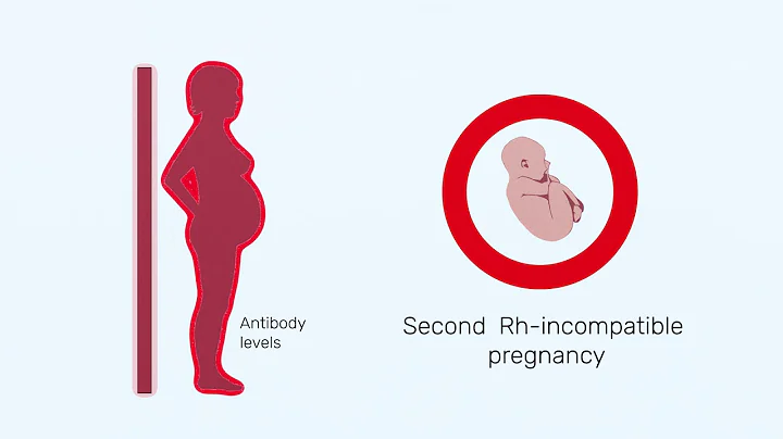 How Rh factor affects a pregnancy - DayDayNews