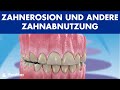Zahnerosion, Abrasion, Wurzelresorption und andere Zahnabnutzung ©