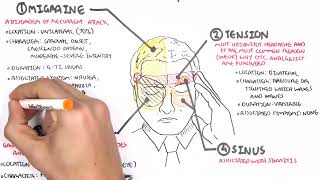 Headache   Overview types, signs and symptoms, treatment