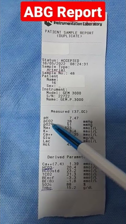 ABG Report(Arterial Blood Gas Analysis)!!