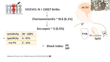 Obstetric sepsis overview | Dr. Pradeep Rangappa