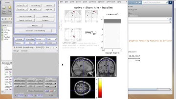 Brain Slice Rendering in SPM