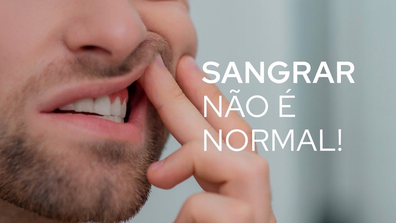 Por que a minha gengiva sangra?