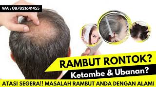 Ajaib Cara Menumbuhkan Rambut Botak Ramping, Botak M, Botak Sulak Hanya Dengan Minyak Kemiri